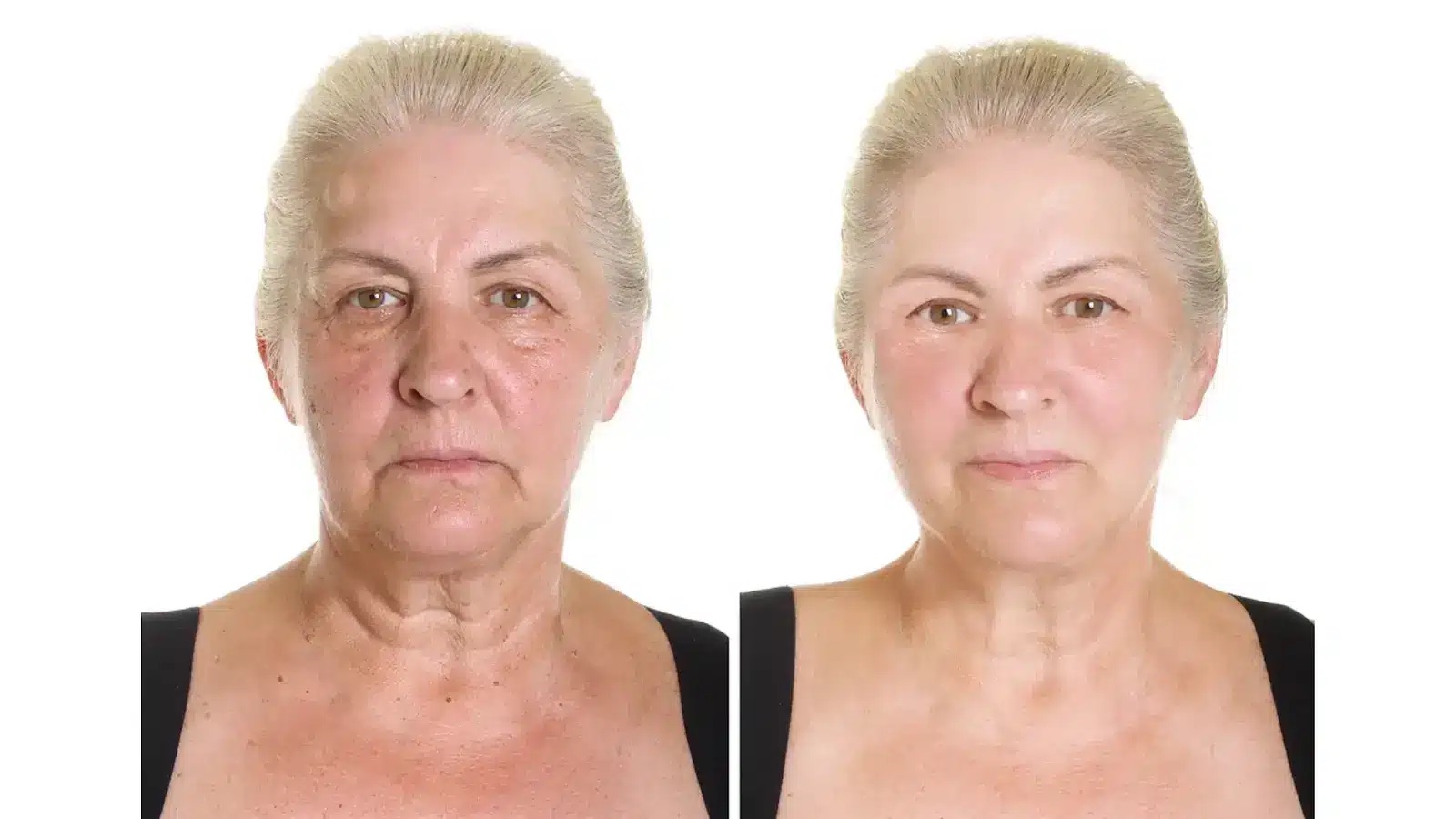 EJAL 40 előtte-utána 3